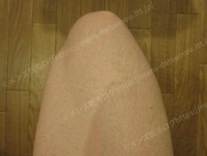40代メンズ医療脱毛：太ももの施術前の毛の濃さ
